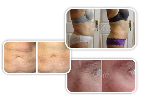 4 - 3 StylePSTPERFECTCHICKEN