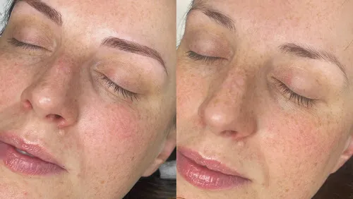 2 - Advanced Hair Design