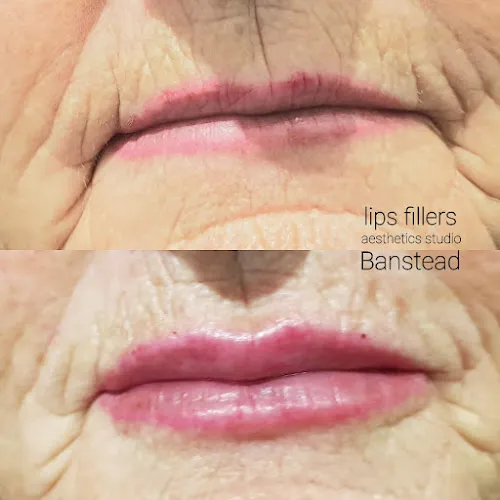 3 - Aesthetics Studio&Botox, Dermal Fillers, Microblading Eyebrows.