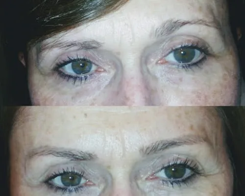 7 - Aesthetics Studio&Botox, Dermal Fillers, Microblading Eyebrows.