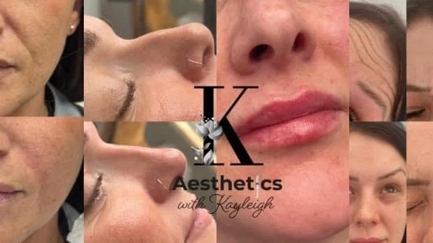 1 - Aesthetics with Kayleigh