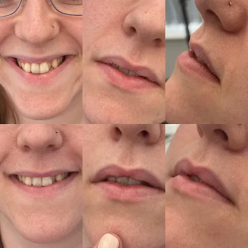 4 - Aesthetics with Kayleigh