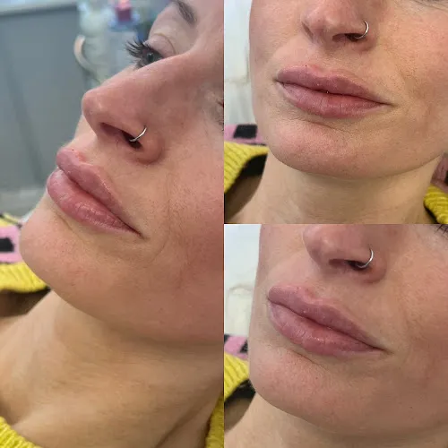 6 - Aesthetics with Kayleigh