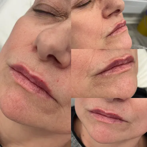 5 - Aesthetics with Kayleigh