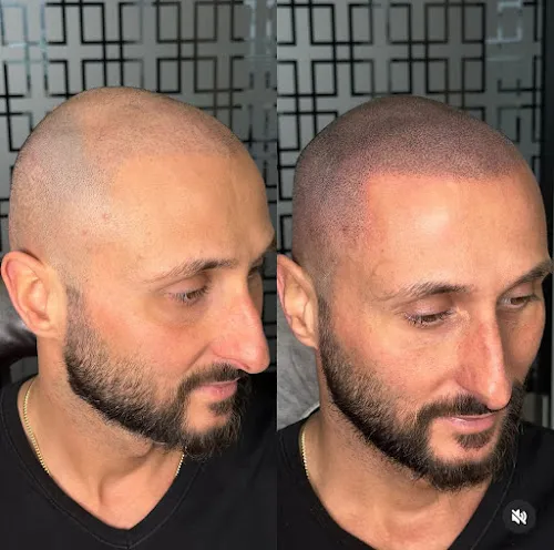 2 - Beau Spa - Stuttgart