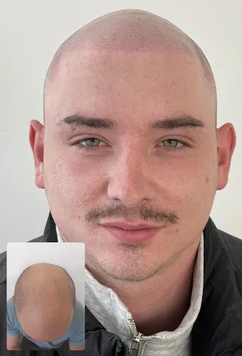 8 - Beau Spa - Stuttgart