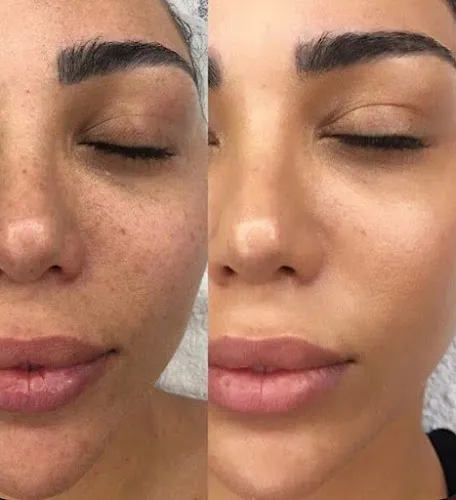 4 - Beauty for Body and Soul Massage Waxing Gel Nägel Nails Kempten