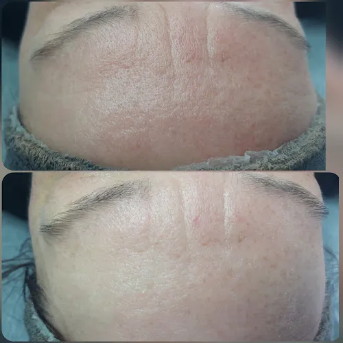 5 - Beauty Pro Lublin