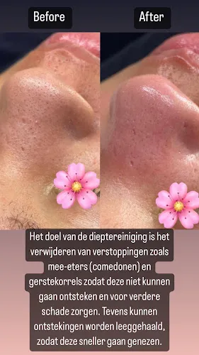 5 - Blendys Beautycenter