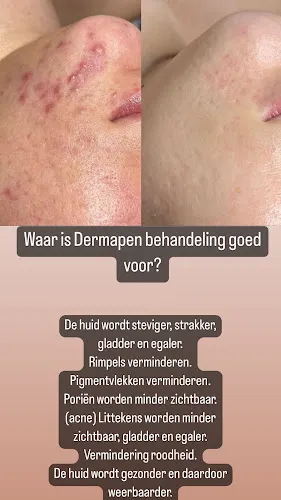 6 - Blendys Beautycenter