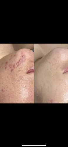 4 - Blendys Beautycenter