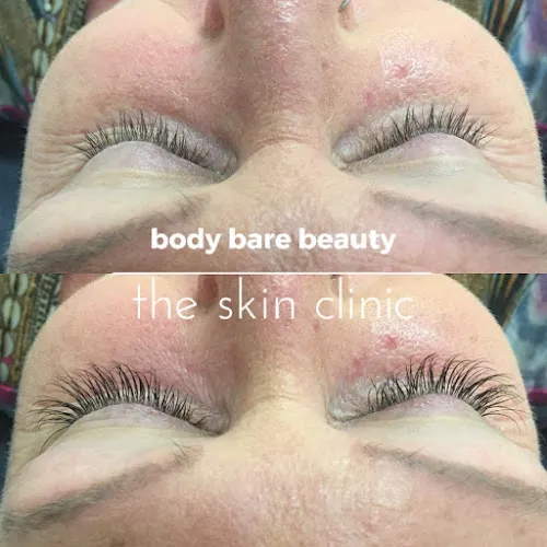 2 - body skin beauty