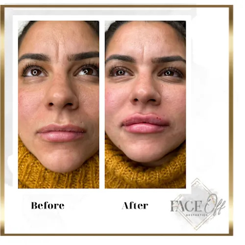 2 - Brush Hair Design