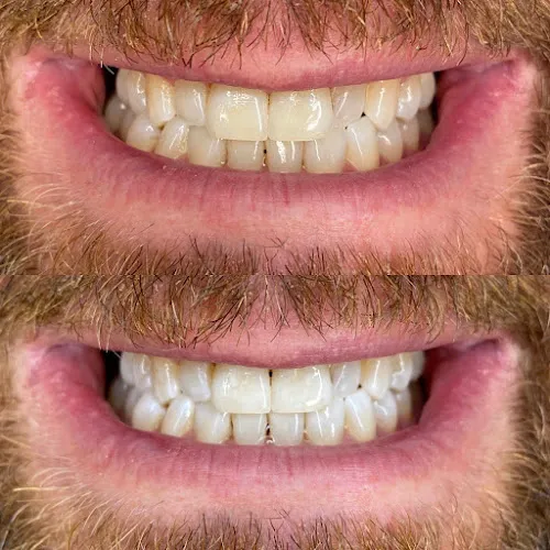 2 - Burgard Mark Friseurmeister