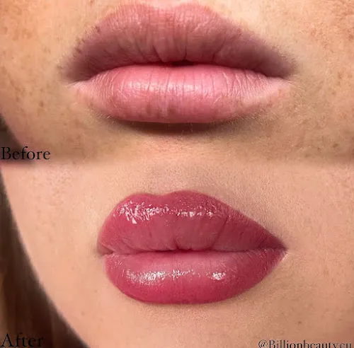 2 - BY BEAUTY FEE # Algenpeeling # Mikrodermabrasion # Anti Aging Spezialbehandlung # Hot Stone Massage