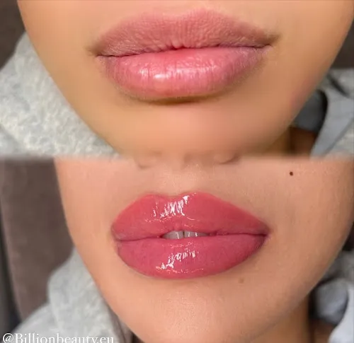 3 - BY BEAUTY FEE # Algenpeeling # Mikrodermabrasion # Anti Aging Spezialbehandlung # Hot Stone Massage