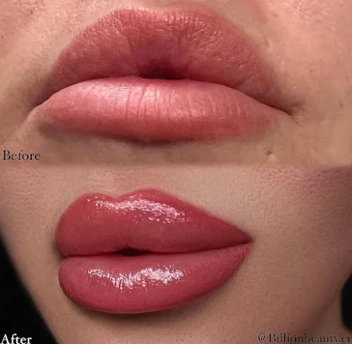 5 - BY BEAUTY FEE # Algenpeeling # Mikrodermabrasion # Anti Aging Spezialbehandlung # Hot Stone Massage