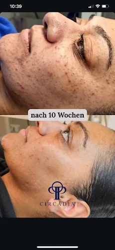 8 - candy nails by Vanessa