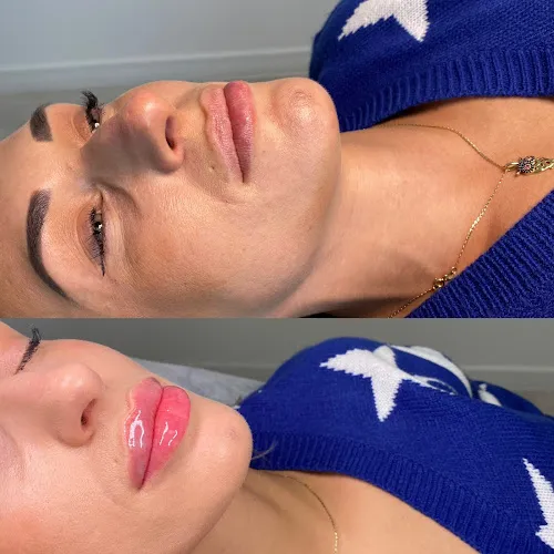 8 - Candy Studio Urody