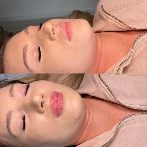 5 - Candy Studio Urody