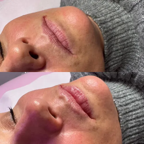 6 - Candy Studio Urody