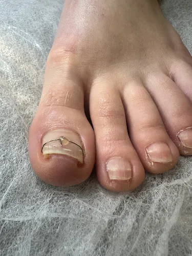 2 - Chan Thaimassasje