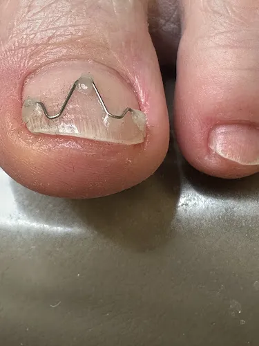 4 - Chan Thaimassasje