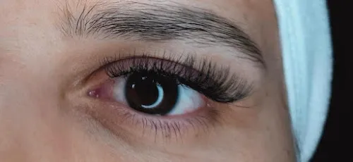 5 - DELUXE LASER - BEAUTY STUDIO - HEAD SPA - LIMBURG