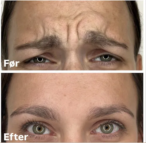 4 - Den Gyldne Saks / Rifai