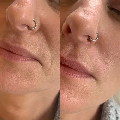 8 - Enis’z traditional Turkish barbers