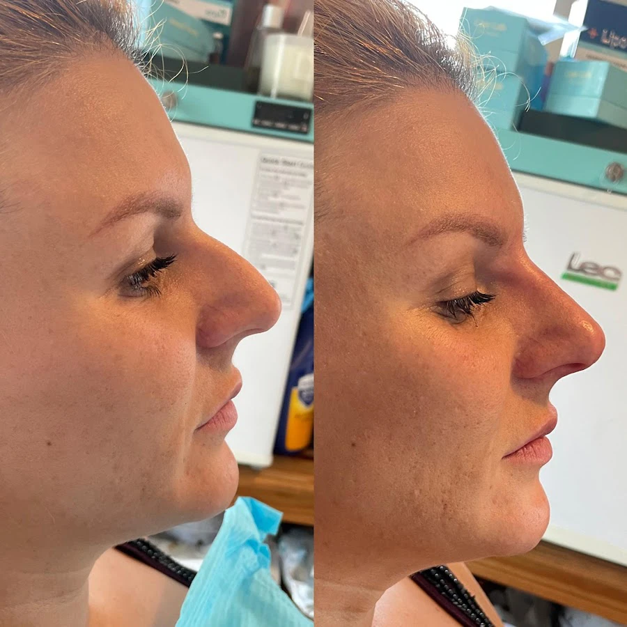 1 - Enis’z traditional Turkish barbers