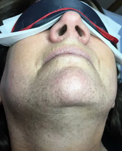 4 - EPIness Electrolysis Studio