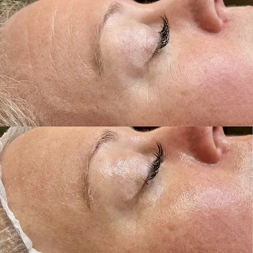 6 - Facial Theory Skin Clinic