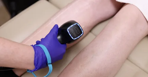 3 - FLÖ MEDICAL AESTHETICS - Botox, Lip filler, Dermal filler, Cheek Augmentation