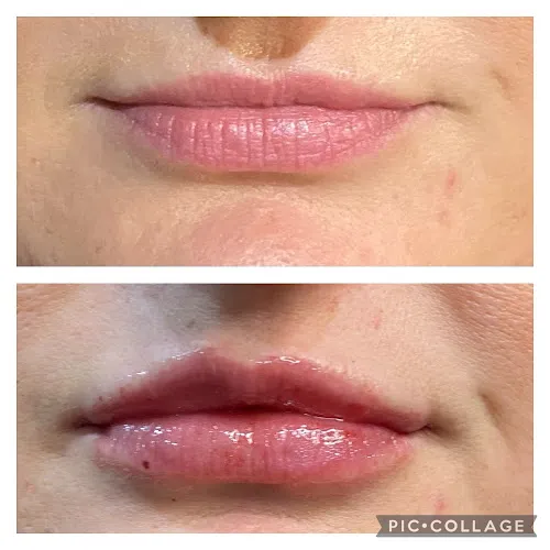 7 - Glow aesthetics and beauty