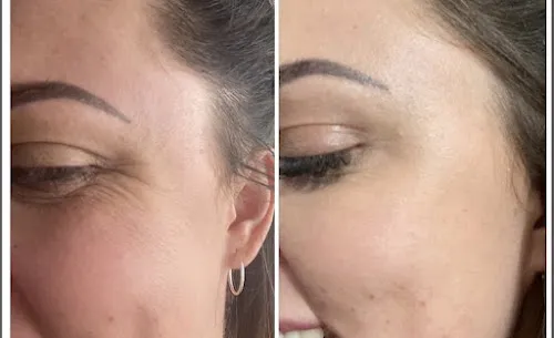 6 - Glow aesthetics and beauty