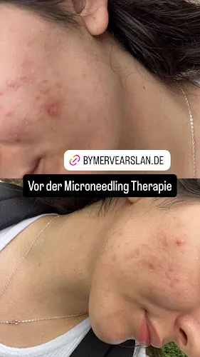 6 - Glow and Grace by Aylin