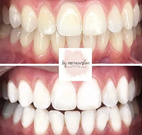 3 - Glow and Grace by Aylin