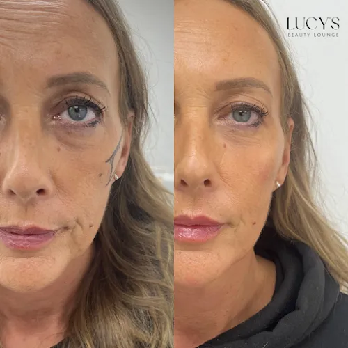 5 - Hair by lil surrey