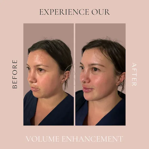 7 - Hair we go again