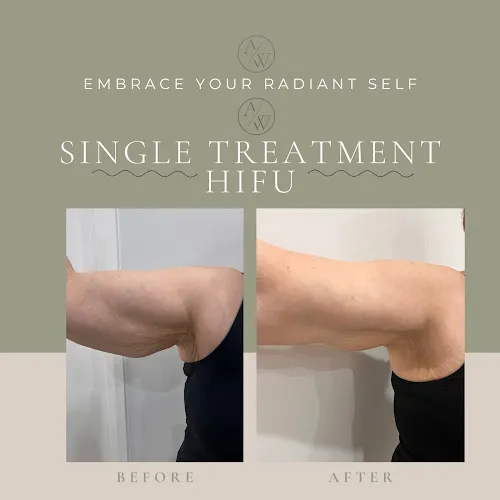 6 - Hair we go again