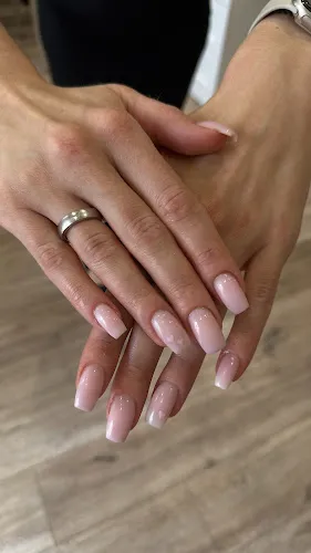 4 - HANNA Beauty&Laser