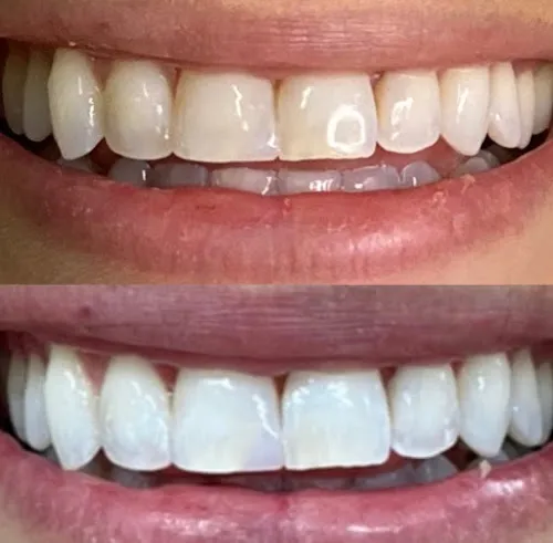 5 - Hi Lites Hair Studio