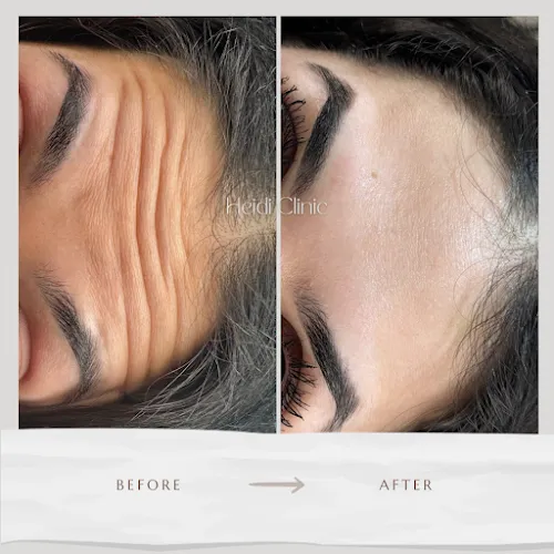 4 - Ilija Salong (Barbershop)