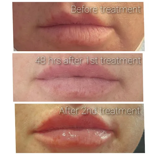 8 - IMAGINATION hair by tony