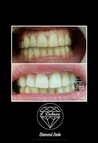 8 - Kapsalon Las Banderas