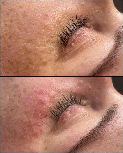 7 - Karwans HairTuning Zülpich