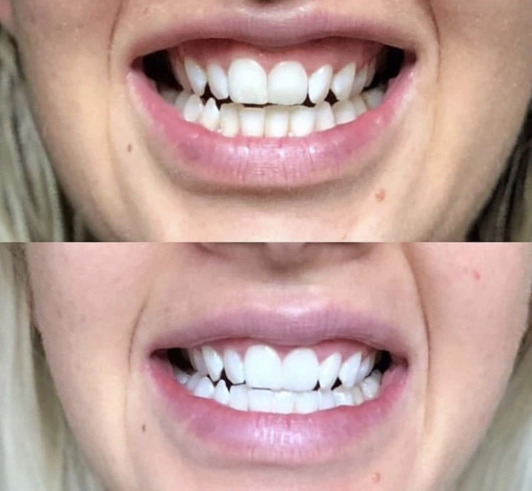 1 - La Fayette Estetica