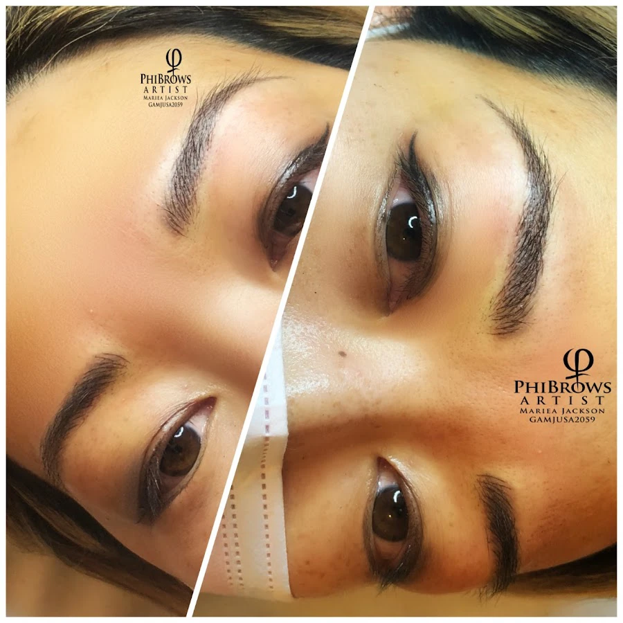 1 - LaEle Aesthetic Finsbury Park