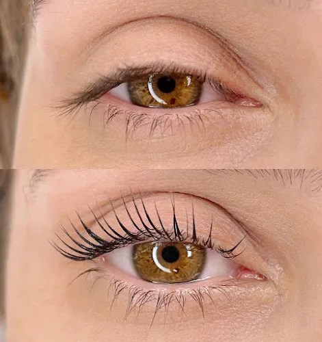 3 - Laser and Beauty by Nina